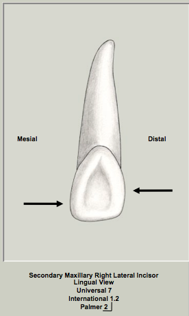 Ext Morph Mx Lateral LIngual 1.png